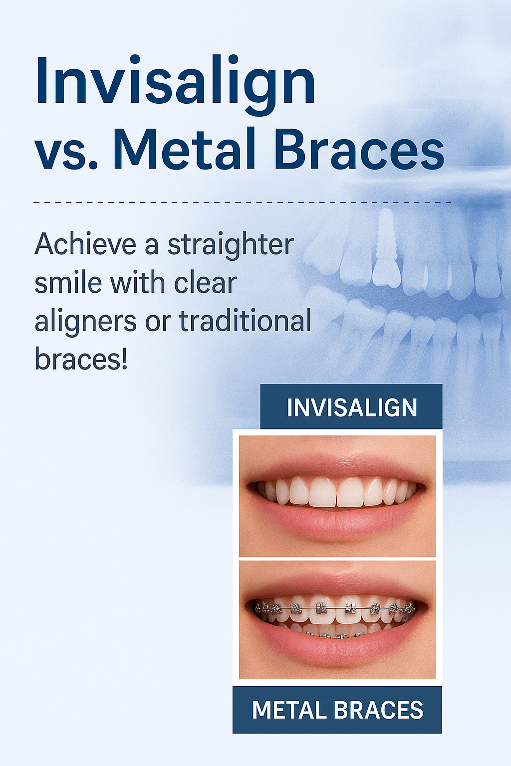 Invisible braces